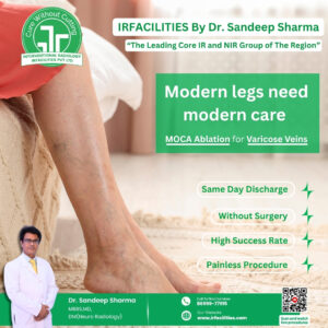 Varicose veins surgery